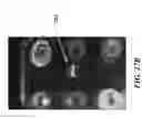 Fig. 48 - Isotachophoresis for purification of nucleic acids