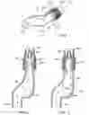 Fig. 02 - Flow diverter with antisiphon