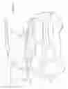 Fig. 02 - Active pedestrian hood latch with dual function cam lever