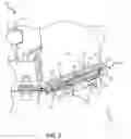 Fig. 03 - Dirt collector system