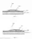 Fig. 41 - Skin stretch feedback devices, systems, and methods