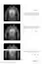 Fig. 09 - Detecting content items in violation of an online system policy using semantic vectors