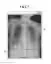 Fig. 06 - Radiographic image processing device, storage medium, and radiographic image processing method