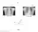 Fig. 02 - Smart imaging using artificial intelligence