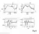 Fig. 06 - Method of detecting a defect in a hearing instrument, and hearing instrument