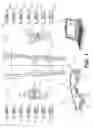 Fig. 02 - Insert sensing system with medial-lateral shims and method therefor