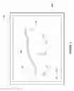 Fig. 10 - Nerve protecting dissection device