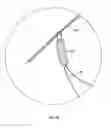 Fig. 09 - KNOTTING TUBE