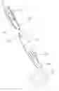Fig. 01 - Devices and methods for reshaping blood vessels