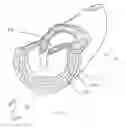 Fig. 02 - Devices and methods for reshaping blood vessels