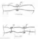 Fig. 04 - Devices and methods for reshaping blood vessels