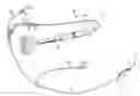 Fig. 01 - System and method for low profile occlusion balloon catheter