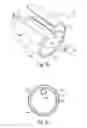 Fig. 22 - System and method for low profile occlusion balloon catheter