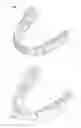 Fig. 01 - Dental appliance with eruption tabs