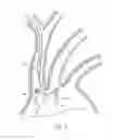 Fig. 04 - Dual endovascular filter and methods of use