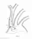 Fig. 05 - Dual endovascular filter and methods of use