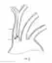 Fig. 06 - Dual endovascular filter and methods of use