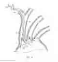 Fig. 07 - Dual endovascular filter and methods of use