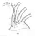 Fig. 08 - Dual endovascular filter and methods of use