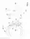 Fig. 09 - Ocular implant with pressure sensor and delivery system