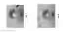 Fig. 08 - Abuse deterrent formulations of amphetamine