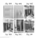 Fig. 43 - Abuse deterrent formulations of amphetamine