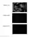 Fig. 22 - Compositions comprising acidic extracts of mastic gum