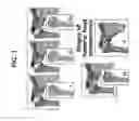 Fig. 02 - METHODS OF TREATING OSTEONECROSIS WITH LLP2A-BISPHOSPHONATE COMPOUNDS