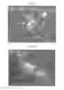 Fig. 02 - Therapy using cardiac stem cells and mesenchymal stem cells