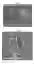 Fig. 03 - Therapy using cardiac stem cells and mesenchymal stem cells