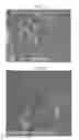 Fig. 04 - Therapy using cardiac stem cells and mesenchymal stem cells
