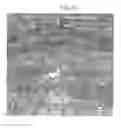 Fig. 06 - Therapy using cardiac stem cells and mesenchymal stem cells