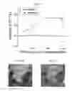 Fig. 09 - Therapy using cardiac stem cells and mesenchymal stem cells