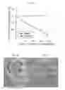 Fig. 10 - Therapy using cardiac stem cells and mesenchymal stem cells