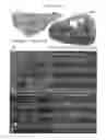 Fig. 23 - Therapy using cardiac stem cells and mesenchymal stem cells
