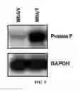 Fig. 02 - PHARMACEUTICAL COMPOSITION FOR PREVENTING AND TREATING CANCER OR CANCER METASTASIS, CONTAINING FSTL1 PROTEIN AS ACTIVE INGREDIENT