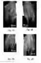 Fig. 02 - Prostaglandin compositions and methods for the treatment of vasospasm
