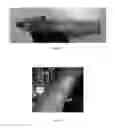 Fig. 06 - Kits, compositions and methods for wound treatment and management