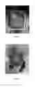 Fig. 07 - Kits, compositions and methods for wound treatment and management