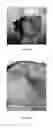 Fig. 09 - Kits, compositions and methods for wound treatment and management