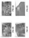 Fig. 05 - Adipose tissue matrices