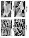 Fig. 06 - Adipose tissue matrices