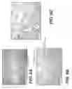 Fig. 10 - Adipose tissue matrices