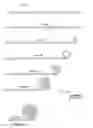 Fig. 02 - ENDOVASCULAR DEVICE CONFIGURED FOR CONTROLLED SHAPE MEMORY DEPLOYMENT IN A BODY VESSEL