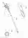 Fig. 02 - Catheter positioning