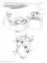 Fig. 04 - Guidewire assembly with intertwined core wire