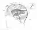 Fig. 01 - Electrical substance clearance from the brain