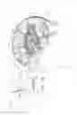 Fig. 03 - Electrical substance clearance from the brain