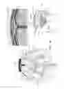 Fig. 11 - Electrical substance clearance from the brain