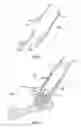 Fig. 22 - Golf club head